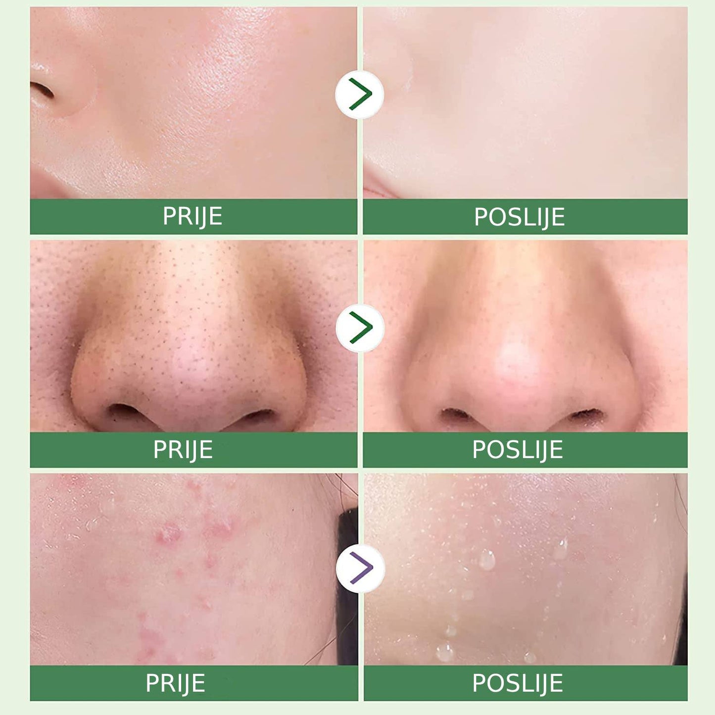 Green maska za lice 1+1 Gratis