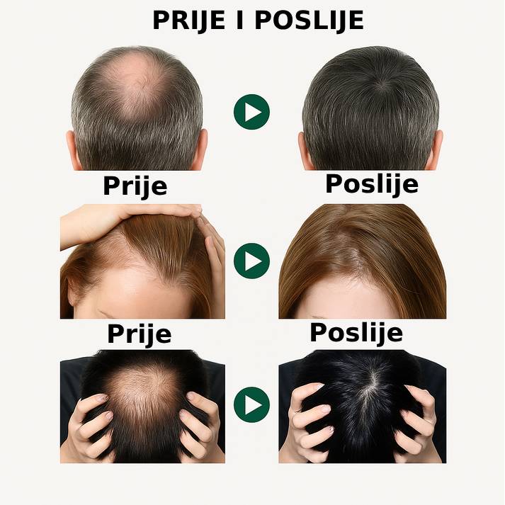 Serum za rast i gustoću kose