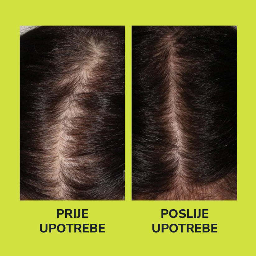 Serum za rast i gustoću kose