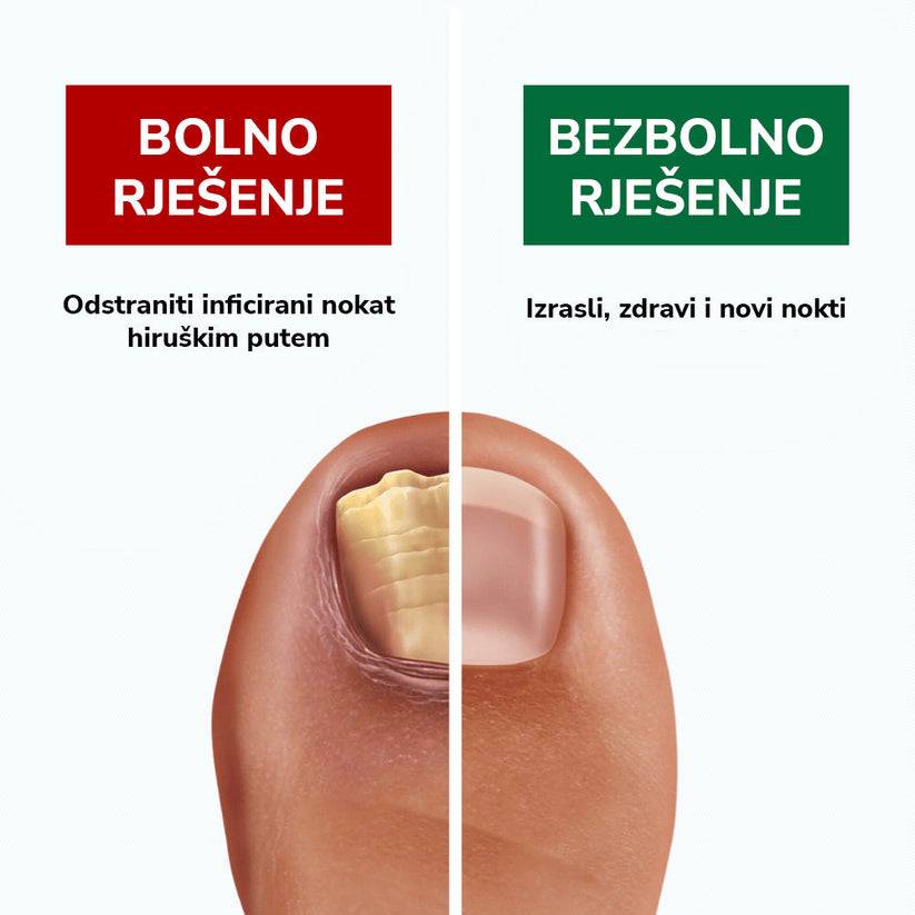 Kapi Protiv Gljivica
