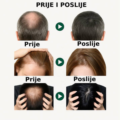 Serum za rast i gustoću kose